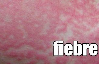 fiebre vaya cuento relatos breves nanorrelatos microrrelatos